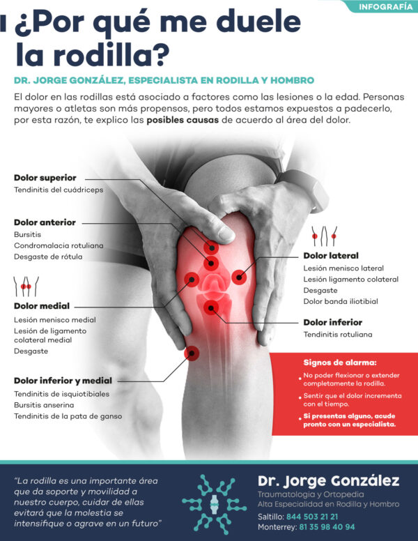 Dolor de rodilla